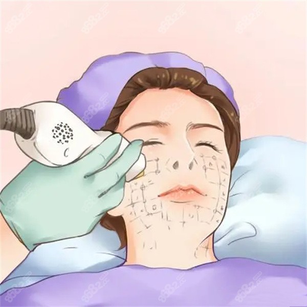 熱瑪吉599元起，面部抗衰價(jià)格真香