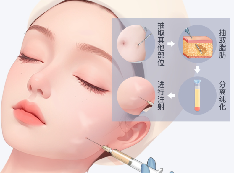 综合性项目