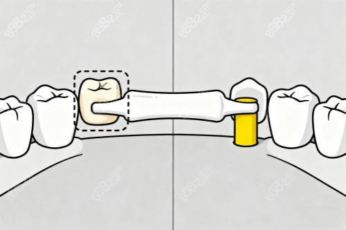 静宁县牙科哪里看得好？马静口腔/樊宗礼口腔看牙技术都好口碑也不错