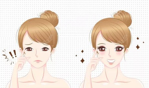 何永强眼修复技术特色解析：针对不对称修复主打小创口细致雕刻+仿生缝合