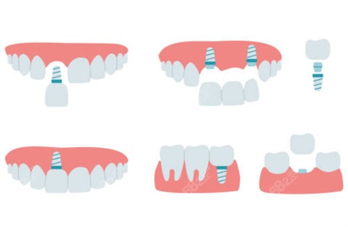 塘厦佳和口腔口碑怎么样？市民反馈资质正规|医生可靠|价格公道值得信赖