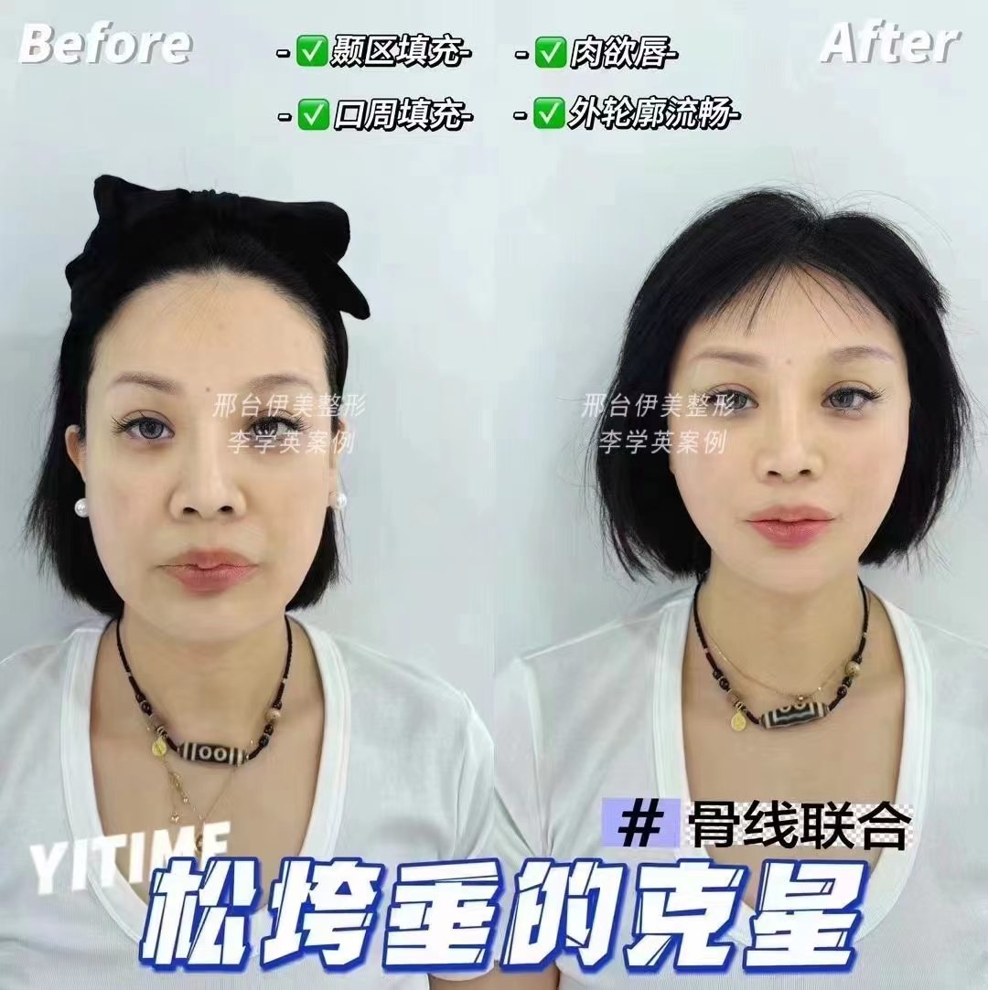 五、北京漾格李在郁醫(yī)生的口碑與優(yōu)勢