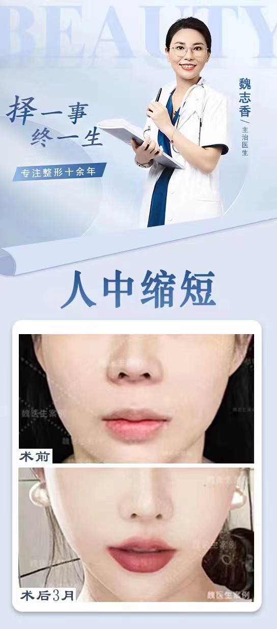 如何預約張冰潔醫(yī)生的手術(shù)