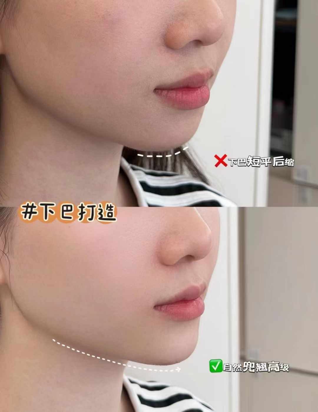 三、北京漾格李在郁醫(yī)生的擅長項目