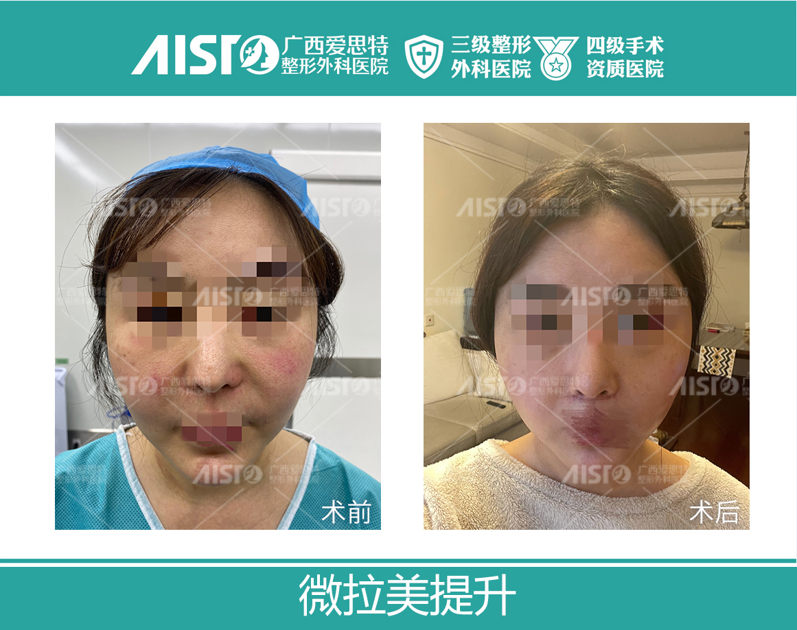 一、鄭州宋連成醫(yī)生簡(jiǎn)介