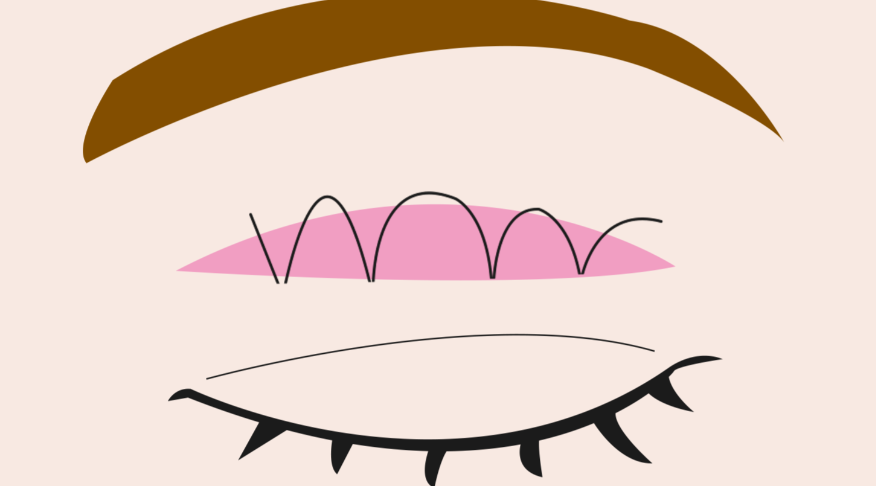 四、如何有效降低風險？三大核心建議