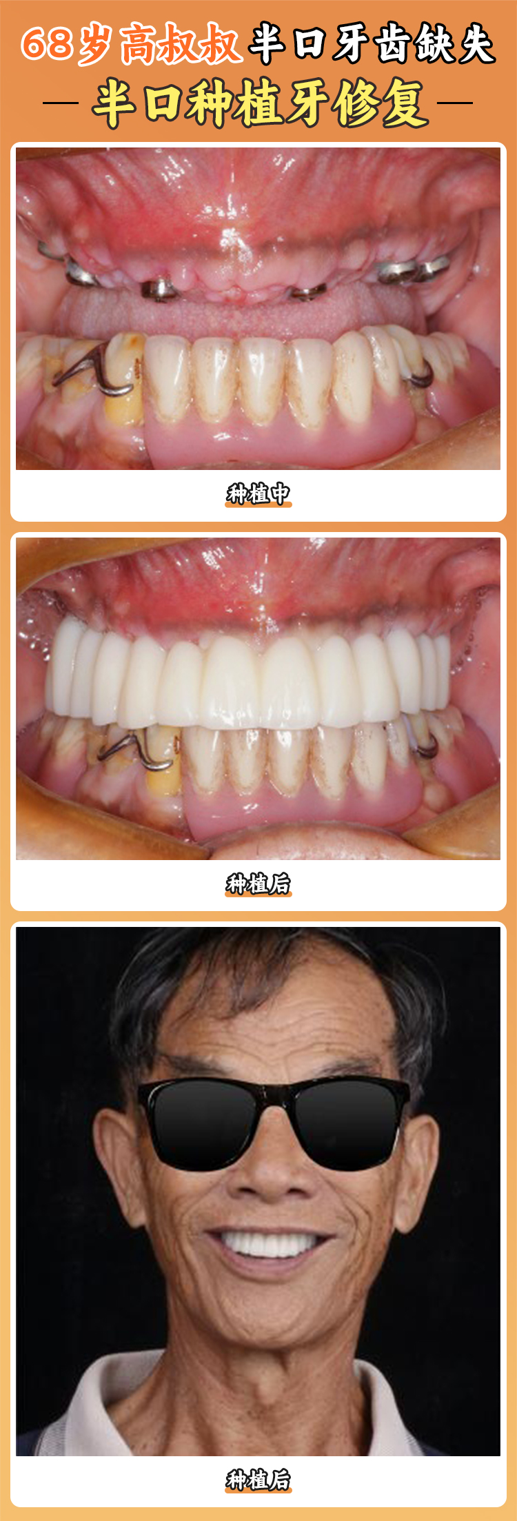 五、蚌埠皓芽口腔的診療項(xiàng)目如何滿足患者的多樣需求