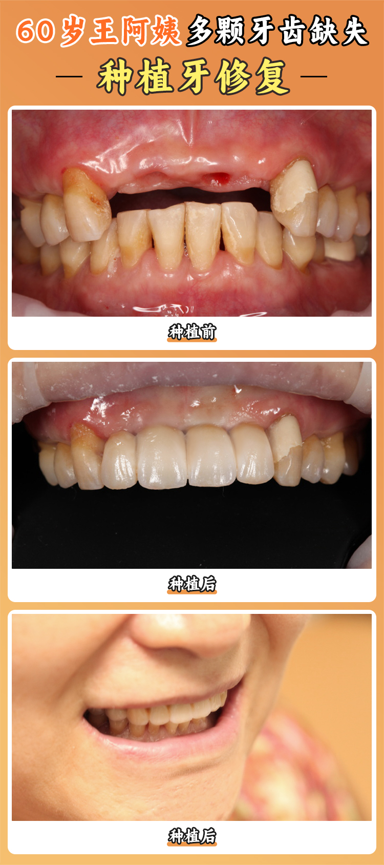 四、蚌埠皓芽口腔的上班時(shí)間和預(yù)約方式對(duì)患者就診有何便利性
