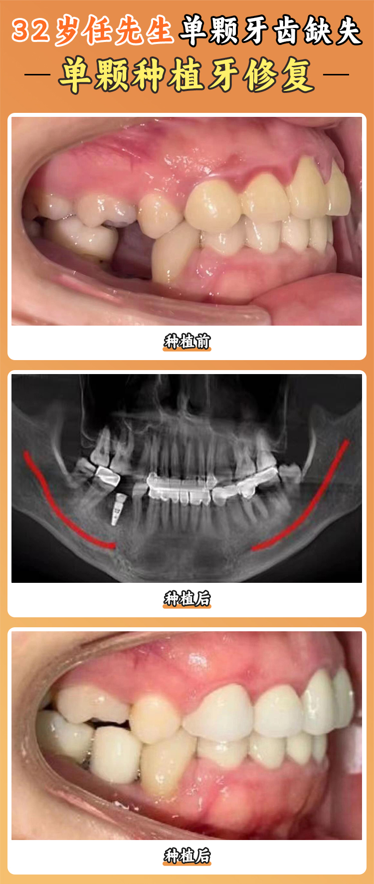 一、蚌埠皓芽口腔是正規(guī)的嗎