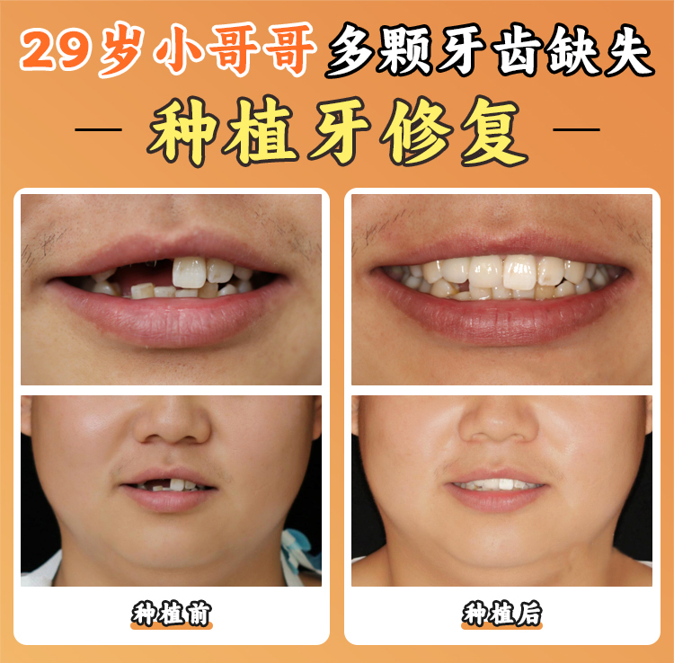 一、牙元素口腔在國(guó)內(nèi)有3家店m.sorencai.cn