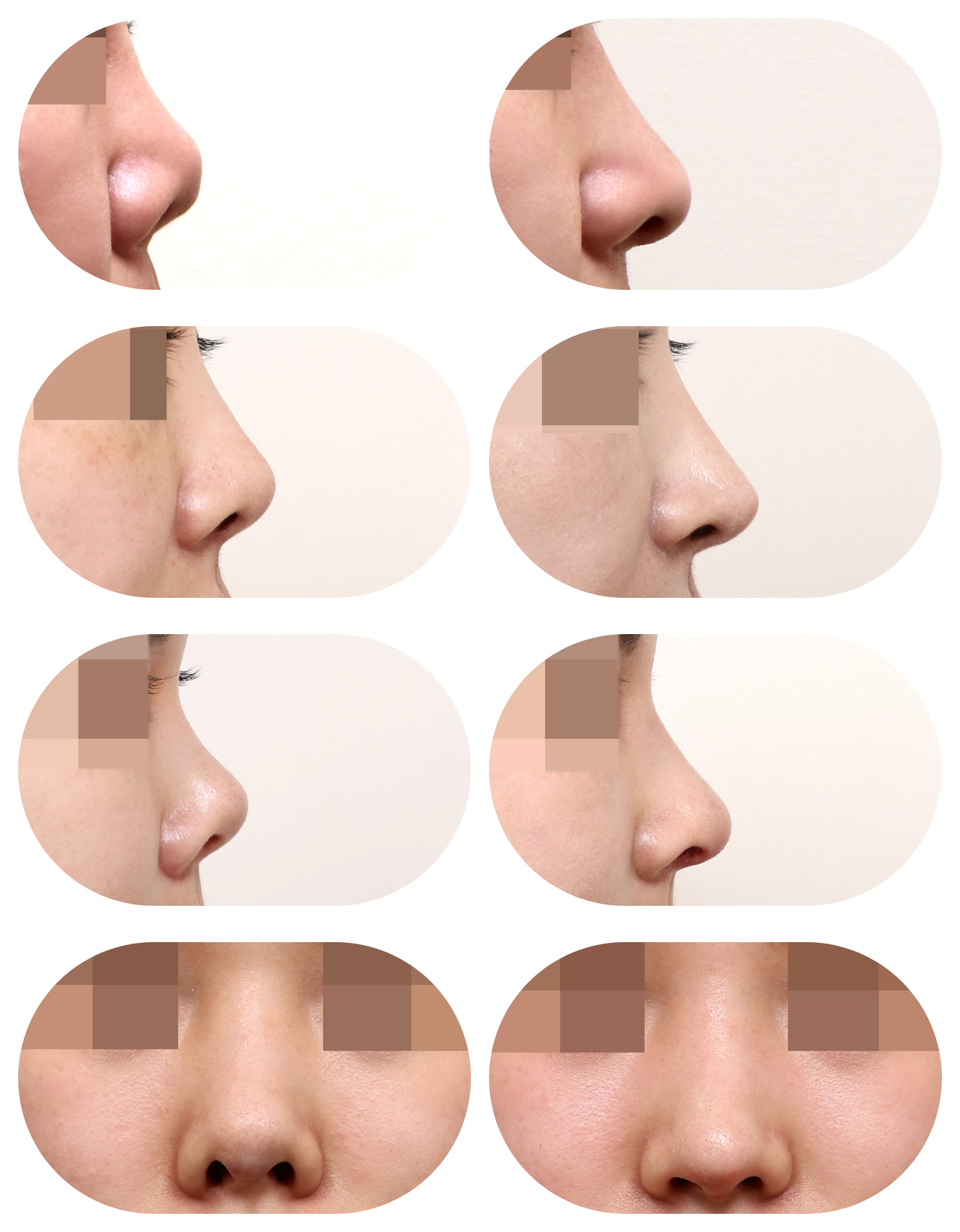 韓國(guó)優(yōu)質(zhì)機(jī)構(gòu)的雙眼皮整形詢(xún)問(wèn)優(yōu)勢(shì)在哪？