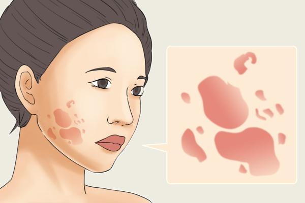 昆明疤痕修復(fù)醫(yī)院排名2026年全新出爐：昆大領(lǐng)銜，美萊韓辰實力上榜