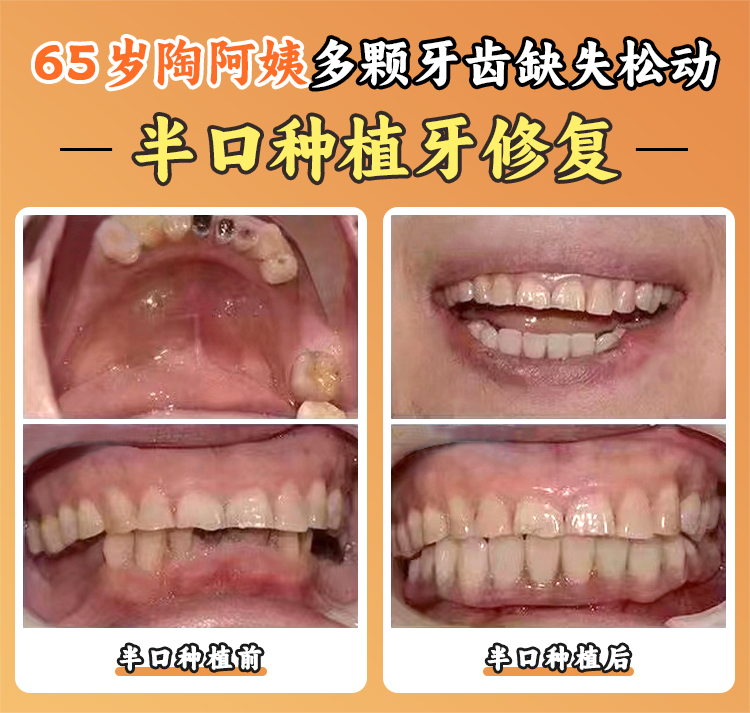 三、深圳童美齒科羅湖店怎么樣m.sorencai.cn