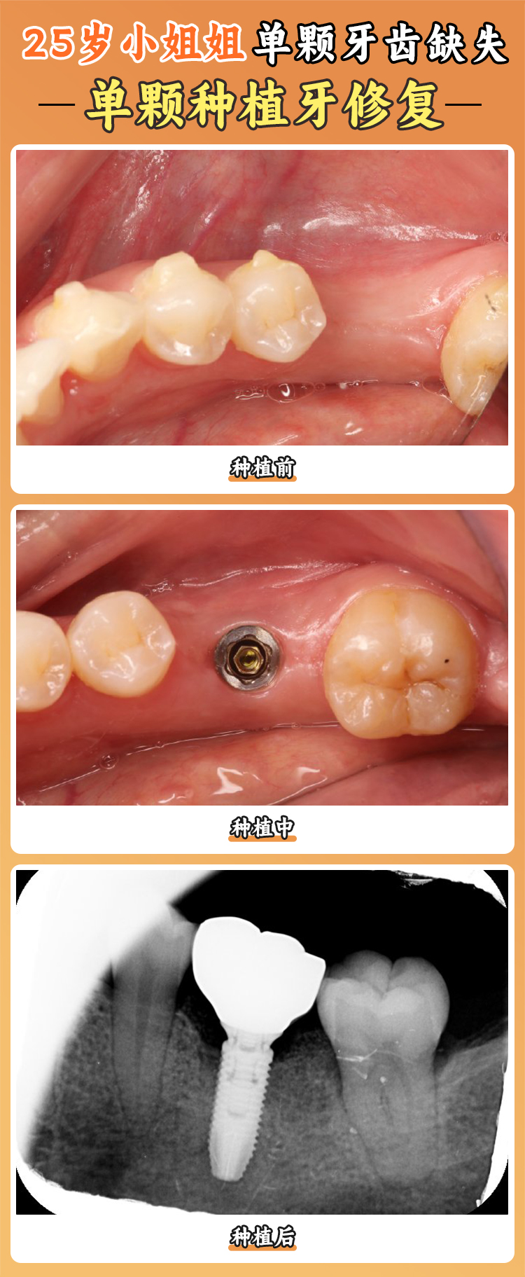 四、邢臺美植口腔全項目價格參考m.sorencai.cn