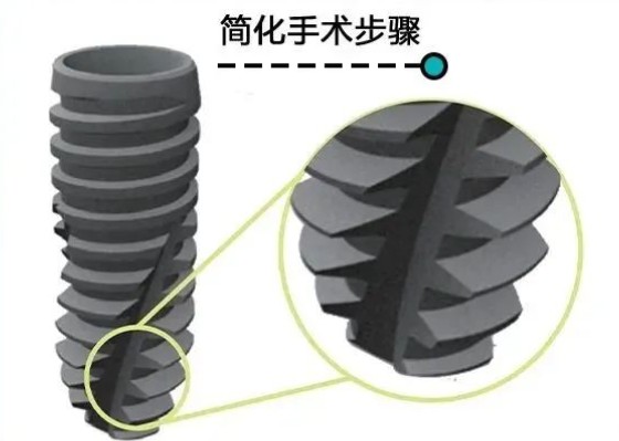 深圳童美齒科怎么樣？羅湖店種植牙3000元起矯正8000元起，連鎖機構(gòu)口碑佳