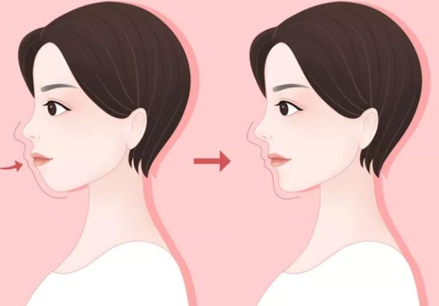 五、廣州王濤正頜醫(yī)生測(cè)評(píng)之靈魂拷問(wèn)（FAQ）m.sorencai.cn