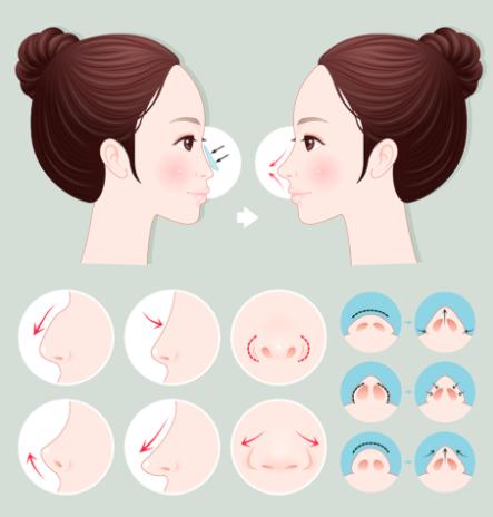 外地患者怎么約？