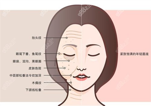 面部抗衰前后