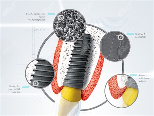 邵東愛(ài)牙仕口腔是正規(guī)的嗎？是，資質(zhì)完善|技術(shù)靠譜|價(jià)格親民|市民信賴