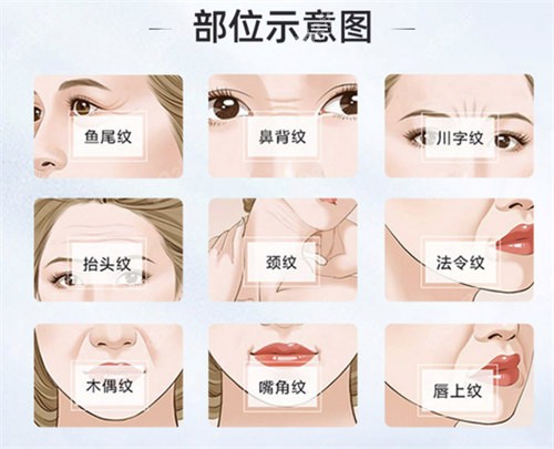 面部除皺部位演示動畫圖