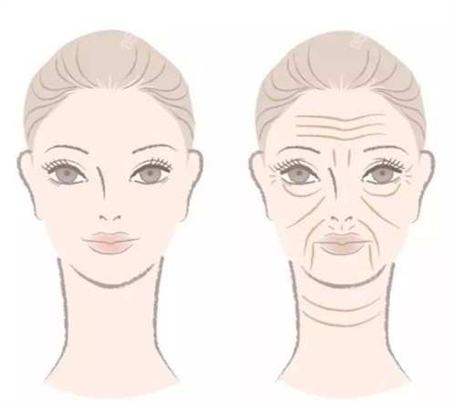 盧宏醫(yī)生北京卓彥麗格怎么樣？20年經(jīng)驗(yàn)+審美在線+擅長聯(lián)合抗衰，光電全