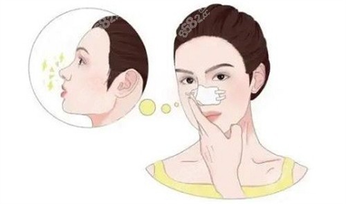 微晶瓷注射隆鼻 微晶瓷注射隆鼻