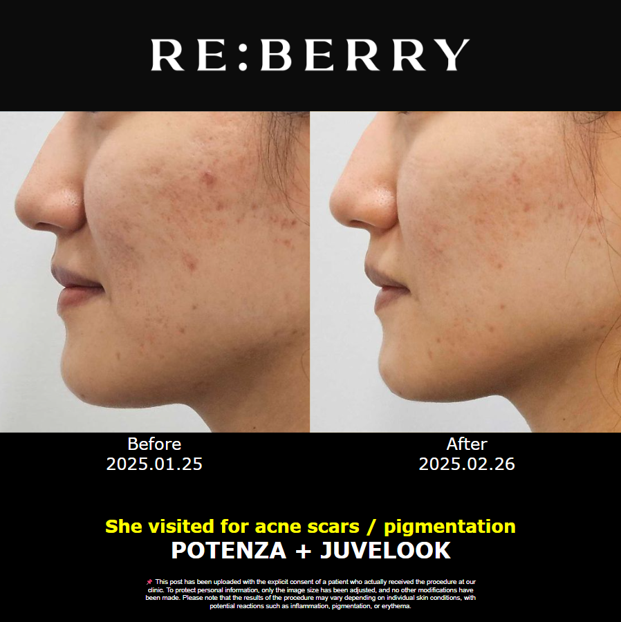 譚拯人中修復(fù)后留疤的影響因素解析