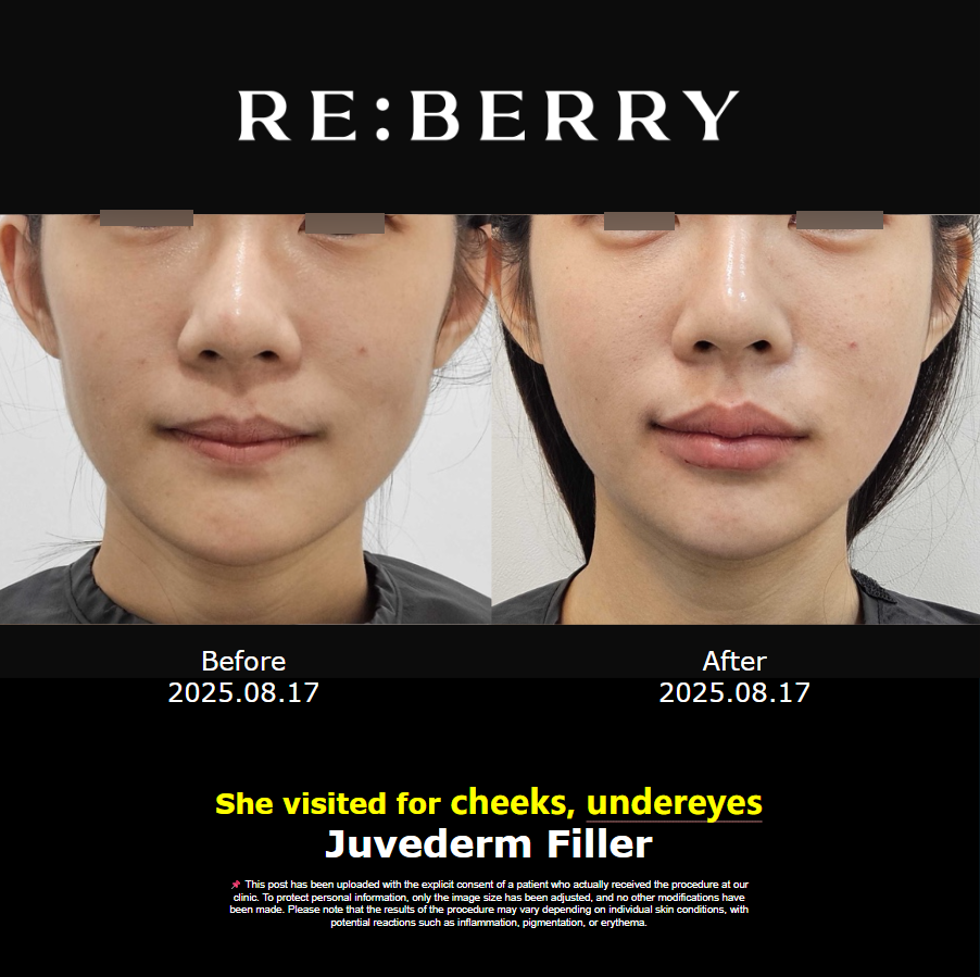 譚拯人中修復(fù)的口碑共識