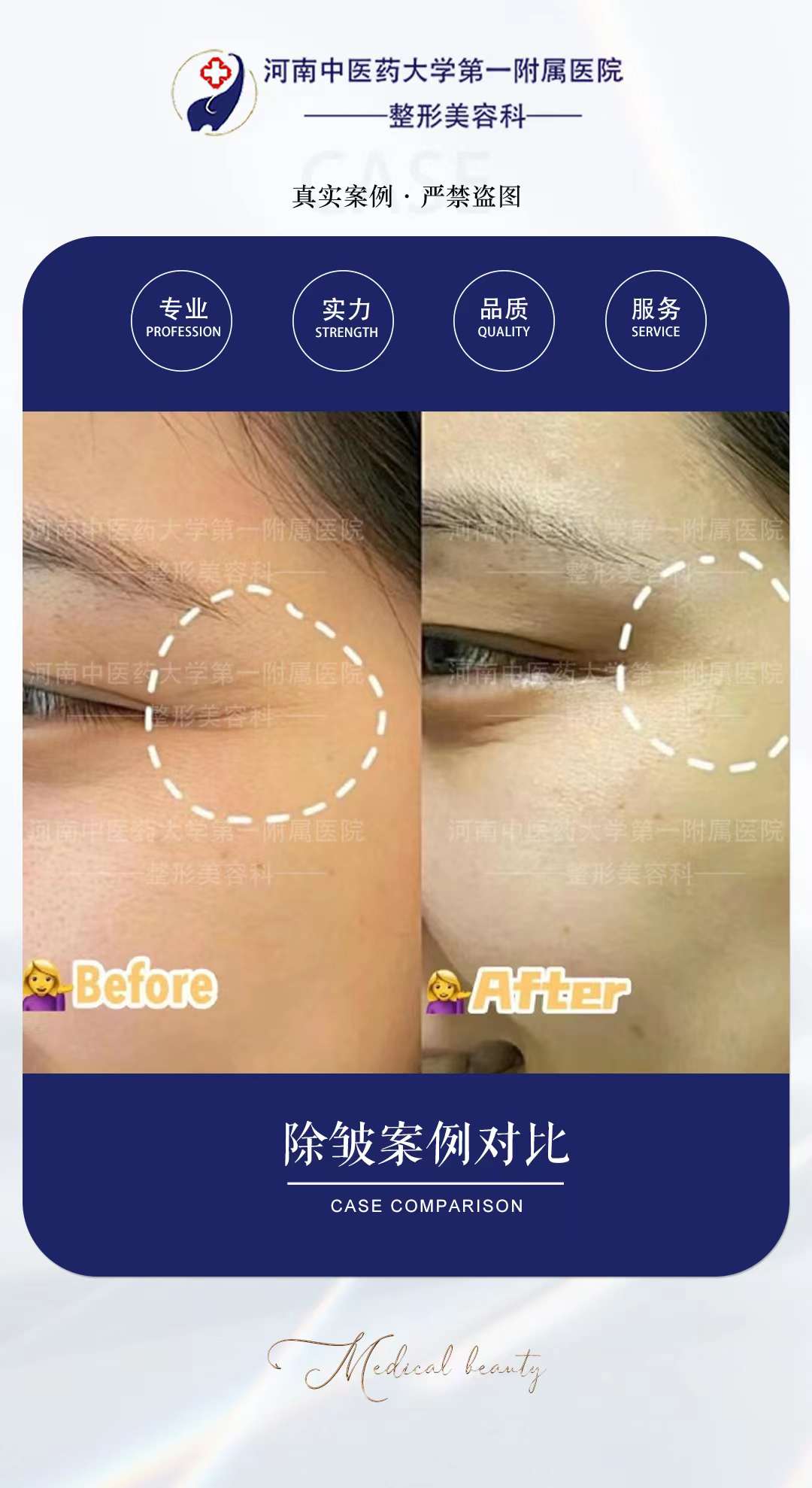 九、鄭州李弋醫(yī)生拉皮技術(shù)值得信賴