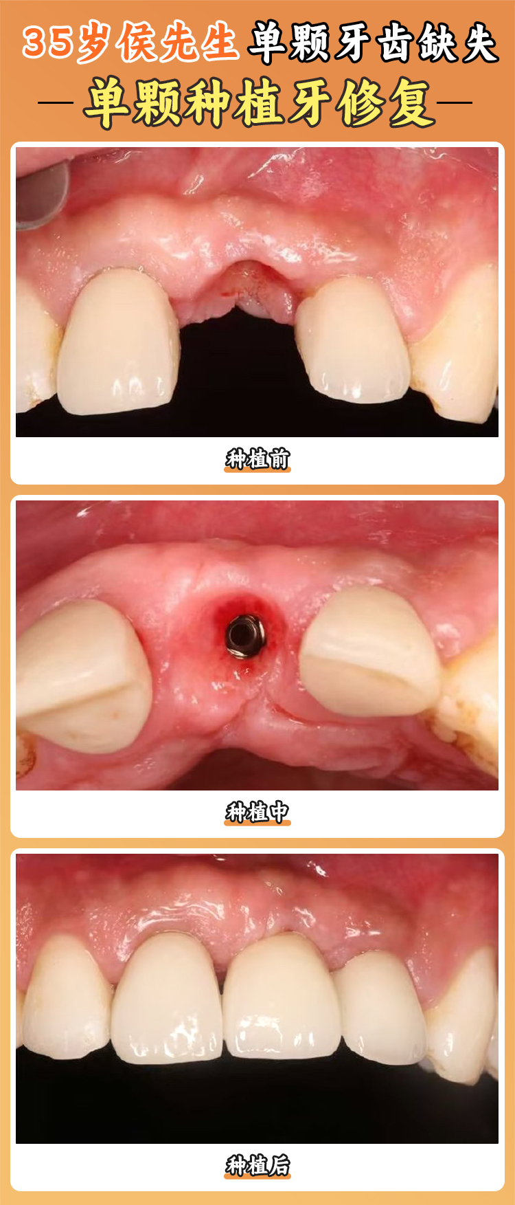 一、成都新橋口腔可以刷醫(yī)療保險(xiǎn)卡嗎？
