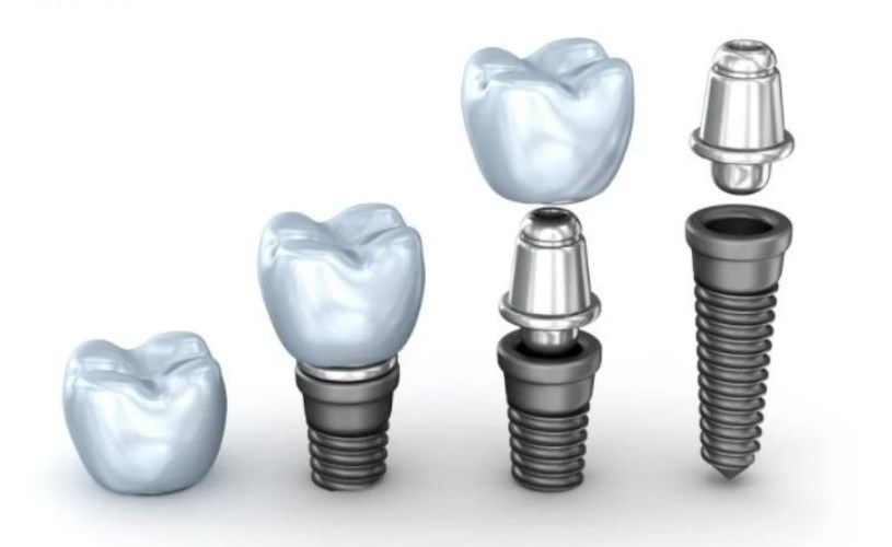 五、成都新橋口腔的優(yōu)勢