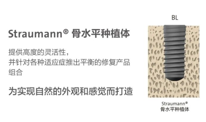 四、成都新橋口腔種植牙/牙齒矯正費(fèi)用情況m.sorencai.cn