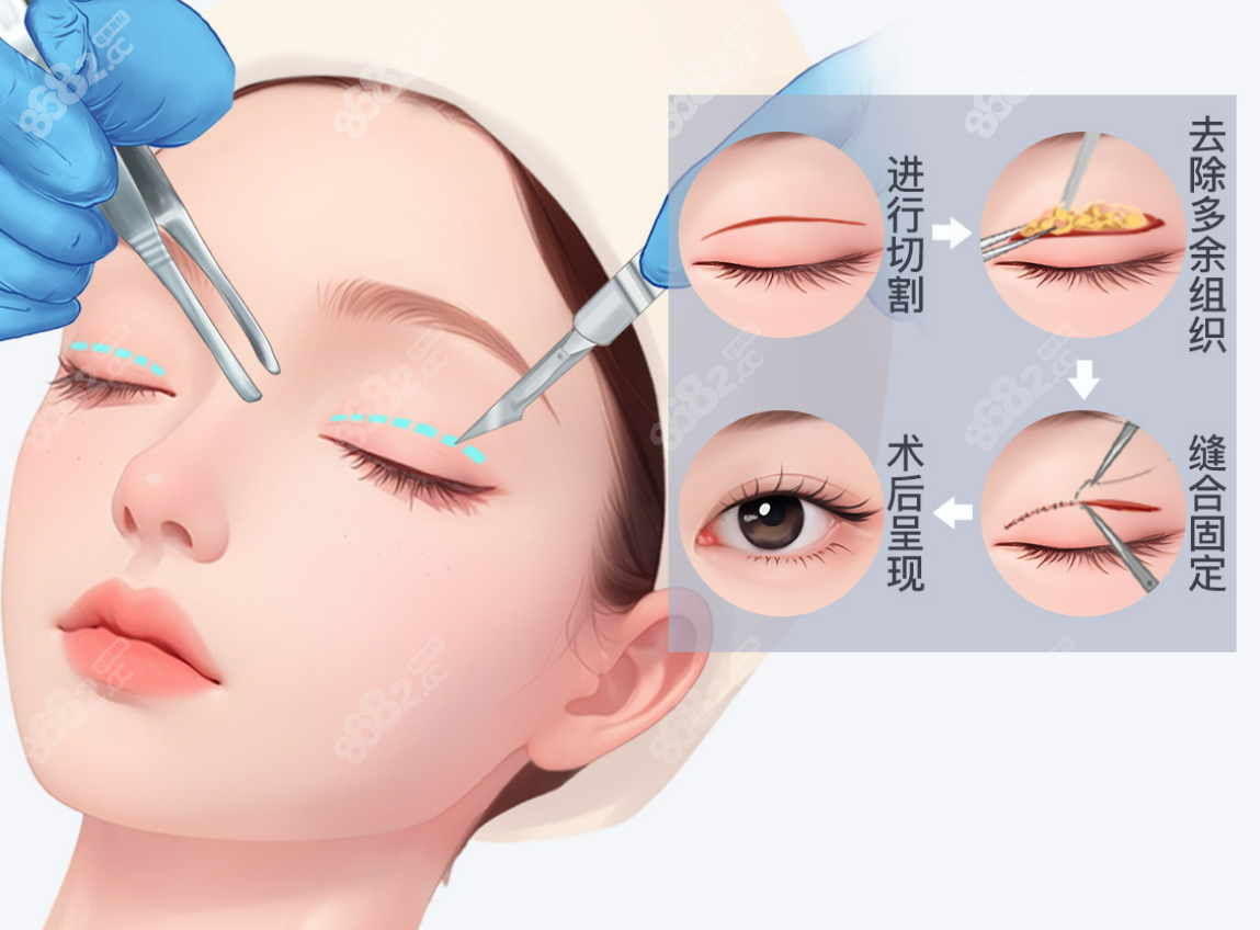 愛(ài)尚麗格眼修復(fù)中心怎么聯(lián)系靠譜