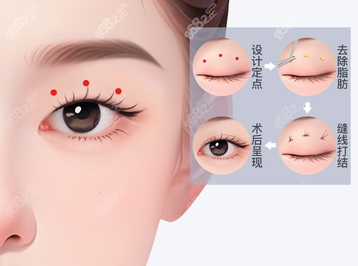 愛(ài)尚麗格眼修復(fù)中心怎么聯(lián)系