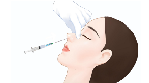 天使針玉衡打鼻子真實(shí)評(píng)價(jià)