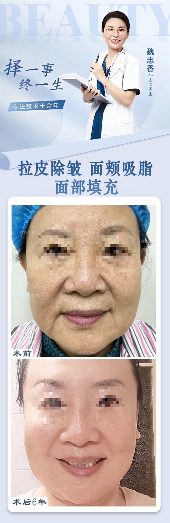 三、價格透明：肉條眼修復2.2萬元起，高難度修復更高可達3.8萬元m.sorencai.cn