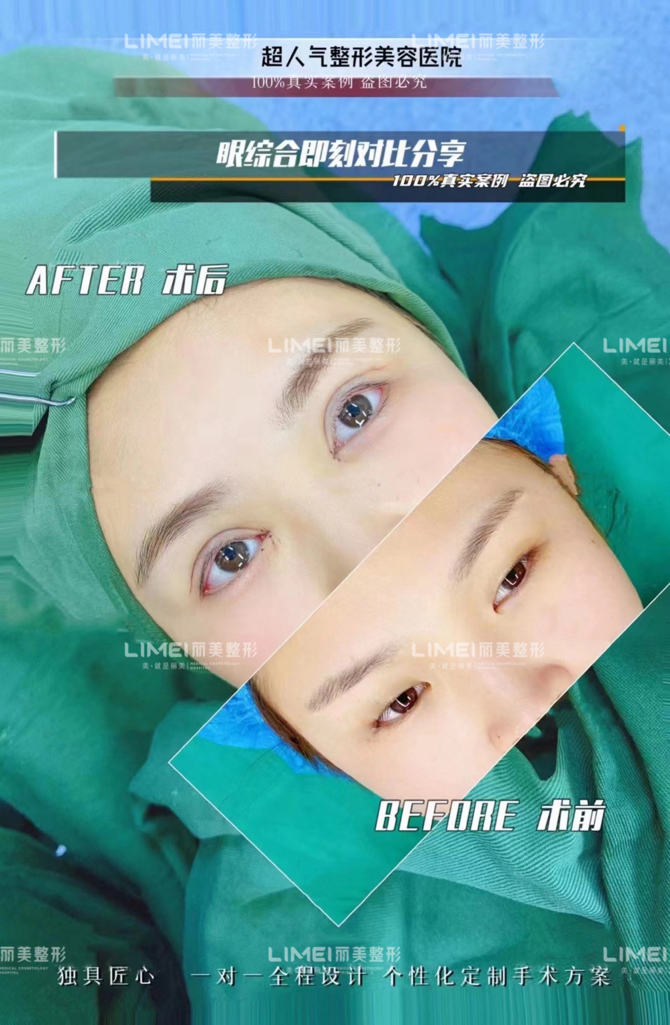 一、為什么大家都說周瑜醫(yī)生“修復技術靠譜”？