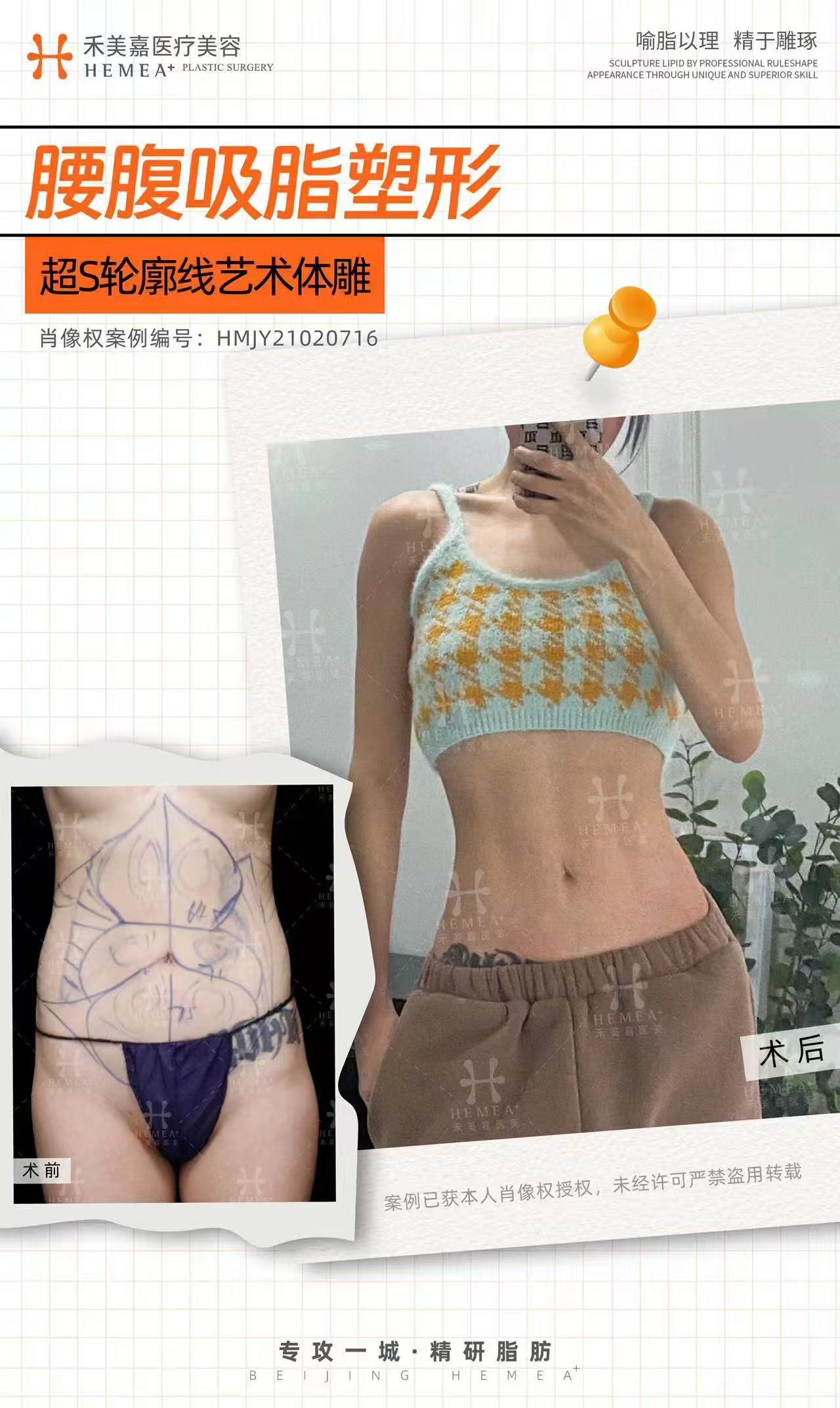 三、三大脂肪骨干醫(yī)生實(shí)力對比