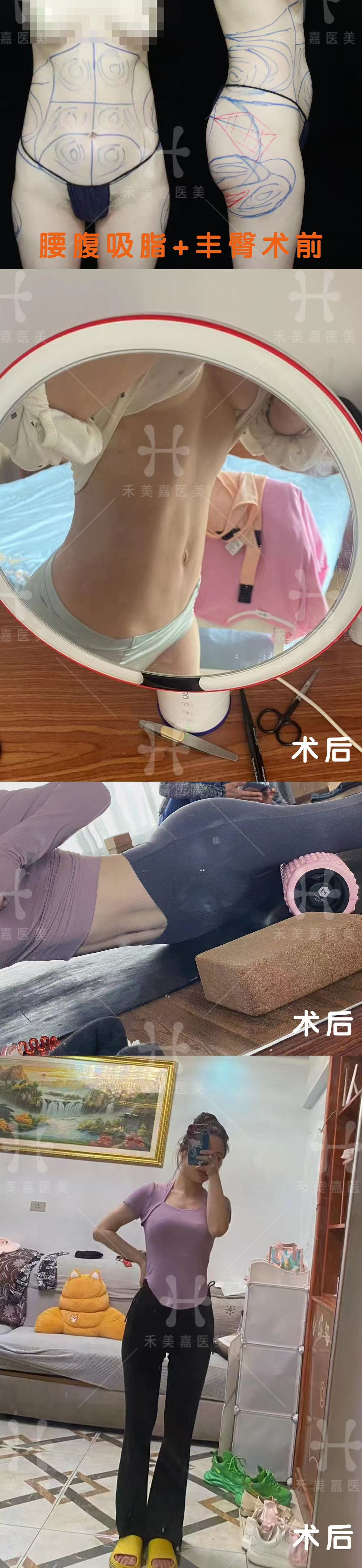 四、禾美嘉為什么貴？三大核心技術(shù)解析