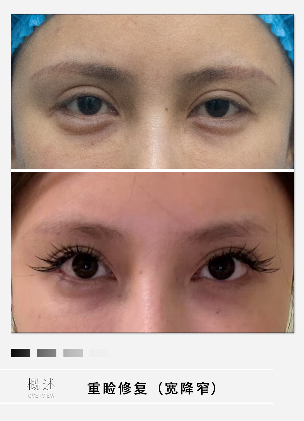 手術(shù)安心性與修復(fù)情況