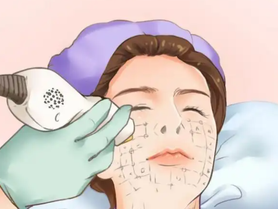 三、超聲炮規(guī)范操作全流程解析：從面診到治療