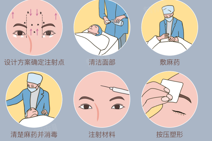 輪廓固定后，臉小了一圈