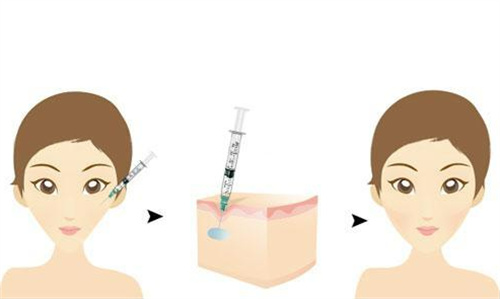 北京漾格李在郁周幾坐診？多年韓系醫(yī)美臨床經驗，面診需提前預留時間，坐診檔期緊張需盡早預約