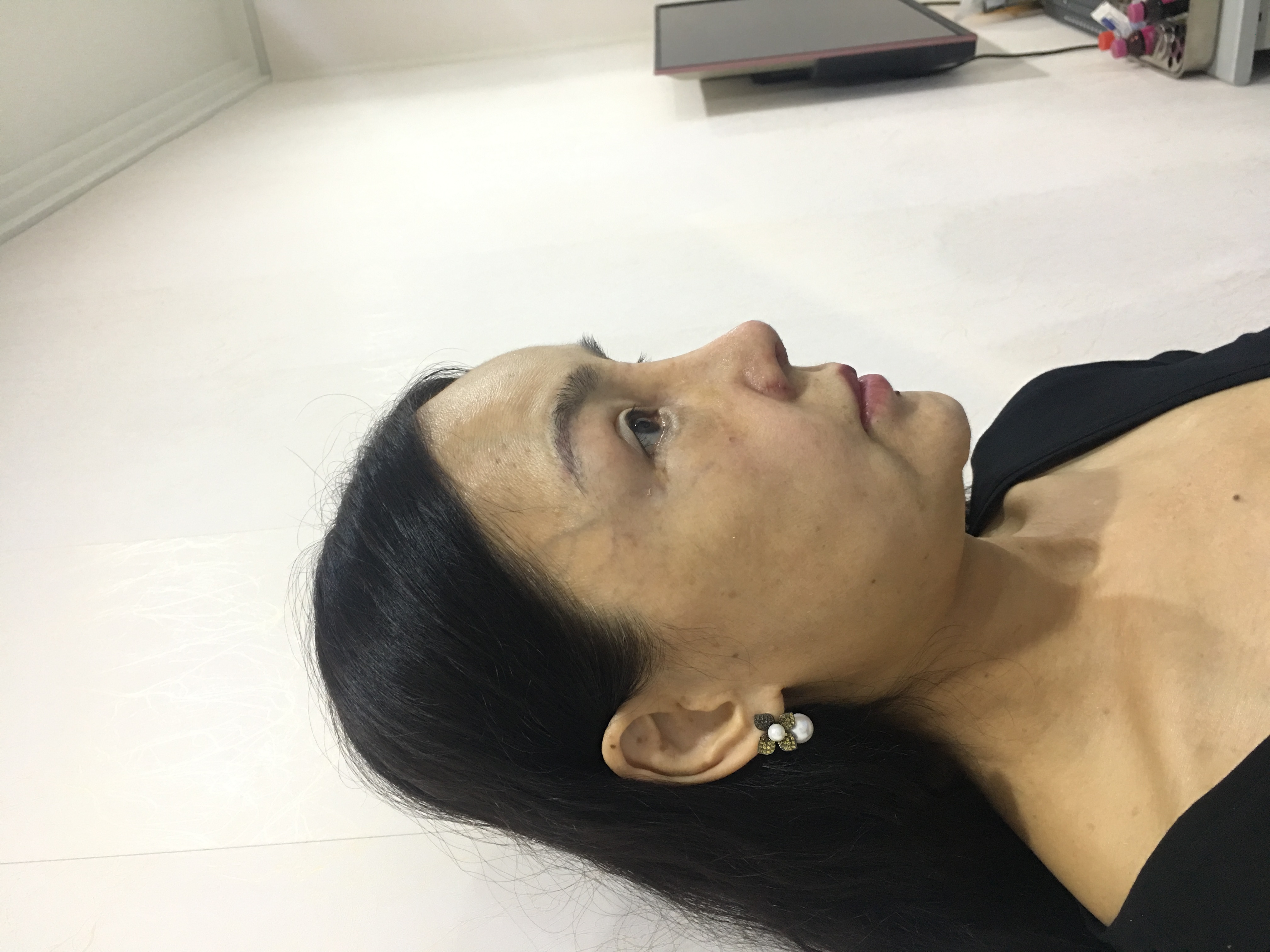 廣州紫馨整形外科醫(yī)院：吸脂技術(shù)成熟