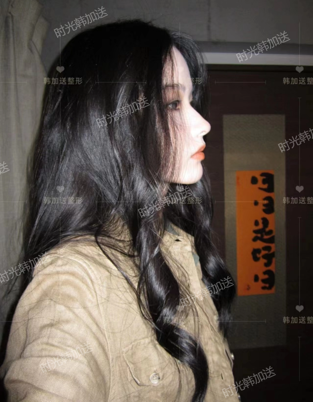 三、王旭明醫(yī)生做鼻子的優(yōu)勢