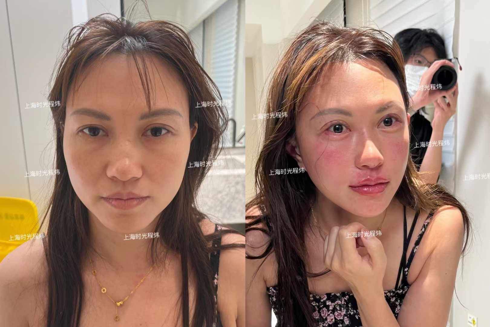 六、周敏茹醫(yī)生的口碑與實例