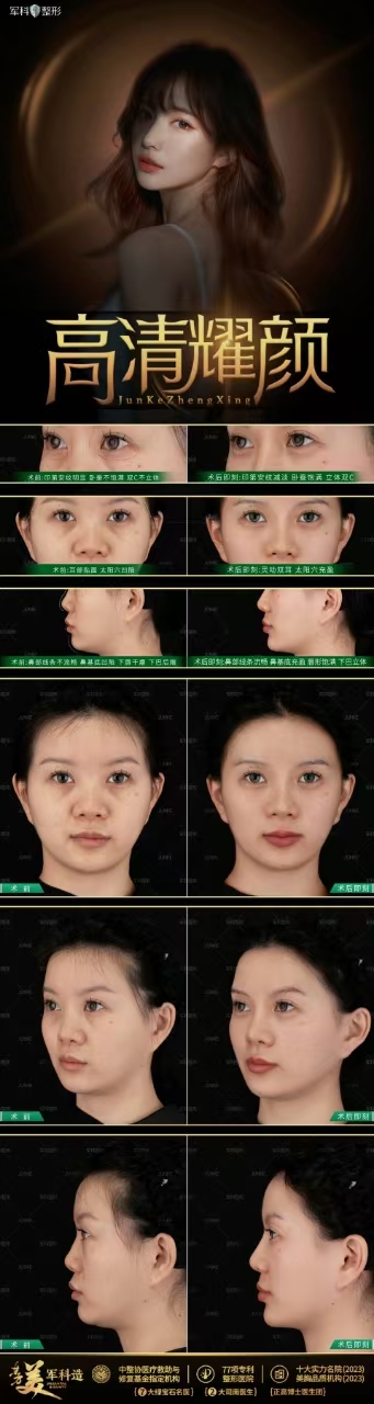 一、王旭明醫(yī)生簡介