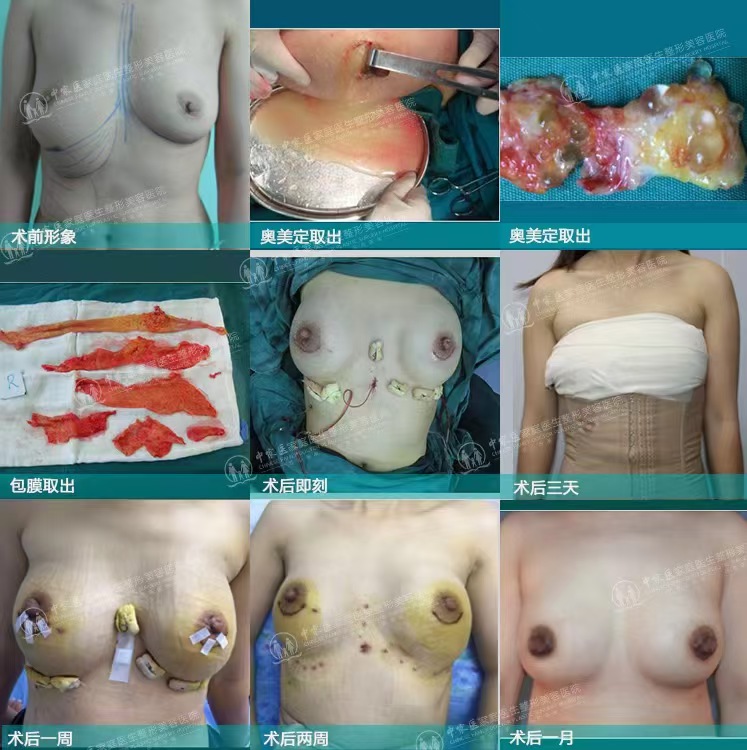 荔灣區(qū)醫(yī)院清奧可信嗎？正規(guī)國有資質+齊云香醫(yī)生團隊，價格6000起性價比高