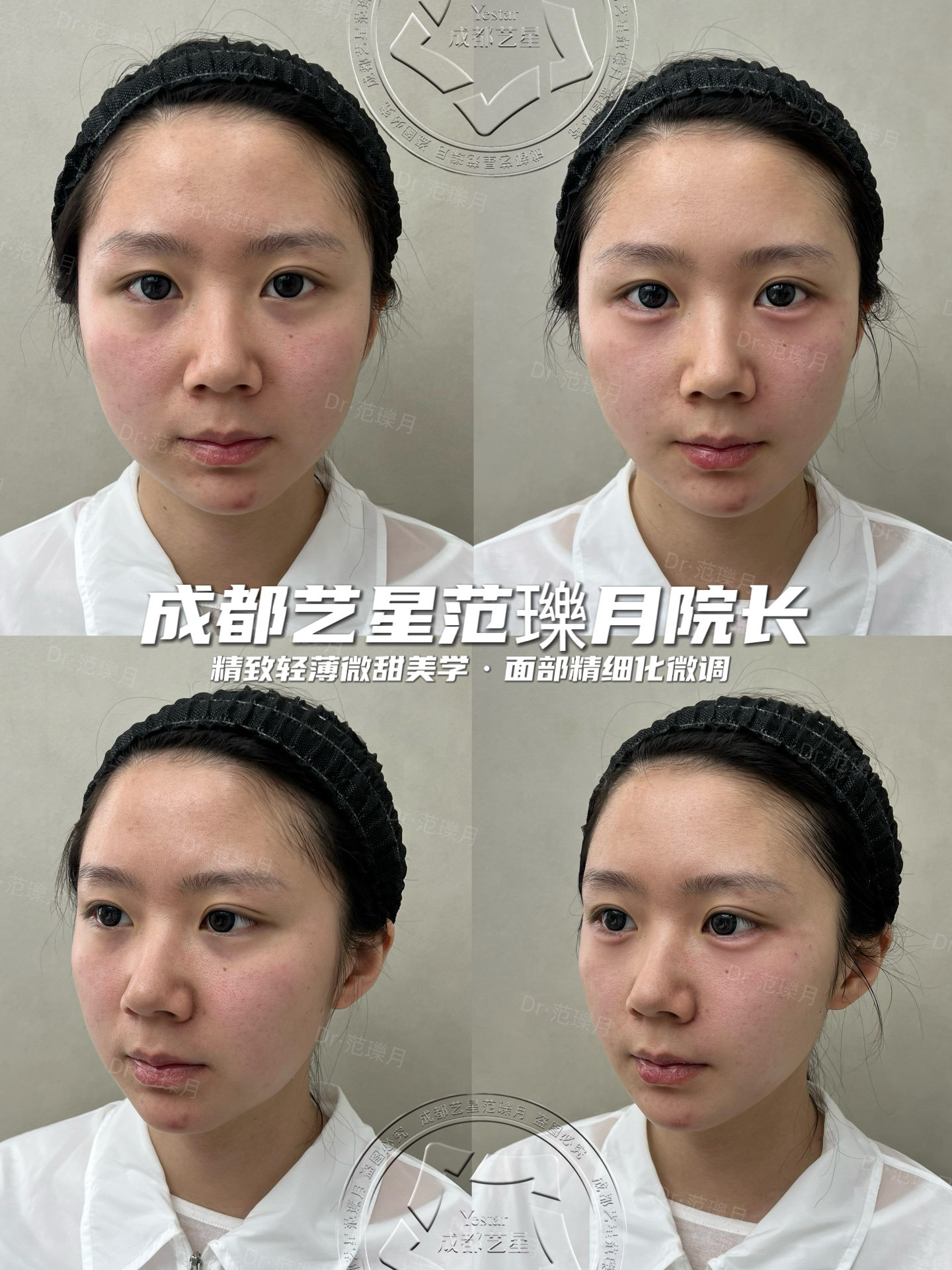 五、李曉東做pst成效總結(jié)