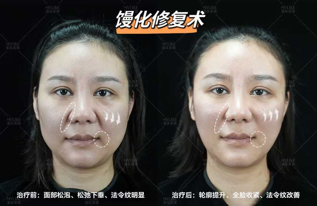 二、北京黎星醫(yī)生做修復(fù)的獨(dú)特之處